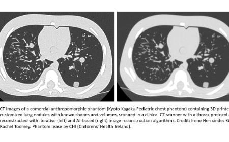 The network aims to collect data on the impact of AI reconstruction tools in clinical imaging and act as a platform for establishing a national interdisciplinary network of radiographers, medical physicists and radiologists. 